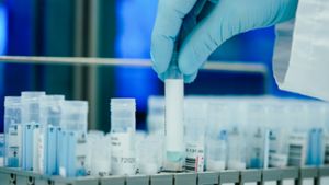Noch werden in den Kliniken Targetuntersuchungen an allen PCR-Tests vorgenommen, um die Omikron-Variante festzustellen. ⇥ Foto: Uwe Anspach